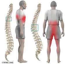 spine_and_neck_care
